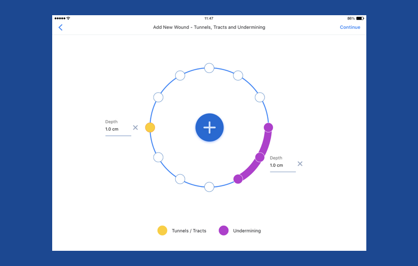 Inteliwound screenshot 4